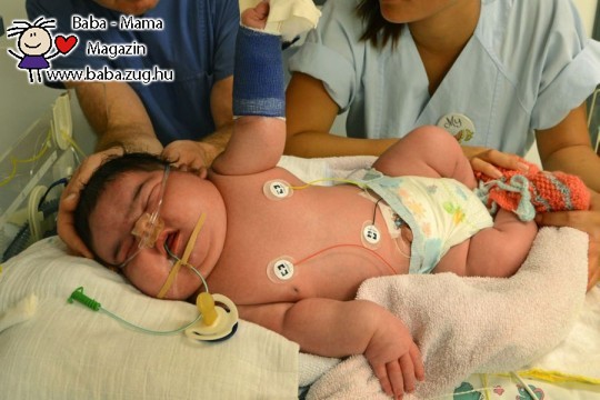Több mint öt és fél kilóval született a kislány